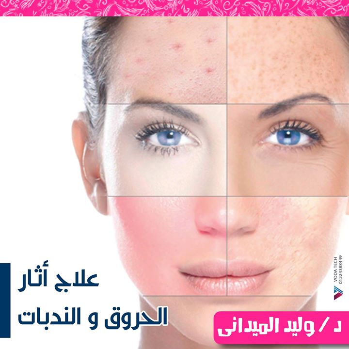 دكتور وليد الميدانى لجراحات التجميل و الليزر